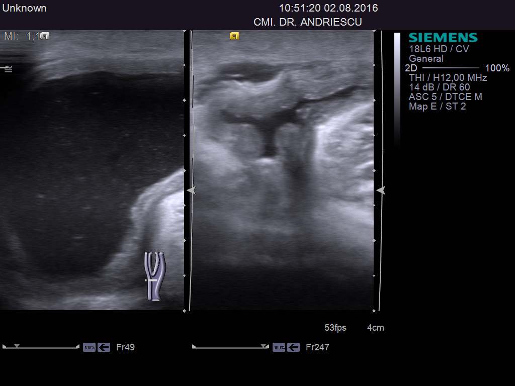 Ultrasonografia Musculoscheletală :: OSTEOMED - Salon Ortopedic | Moldova